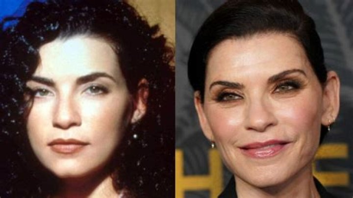 Julianna Margulies Doesn’t Look Natural After Plastic Surgery!